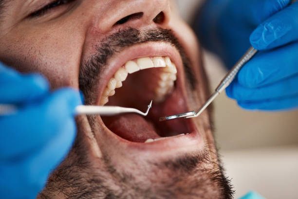 Best Knocked-Out Tooth Emergency  in Douglas, AL